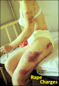 Los Angeles Rape Charges and Sex Crimes Defense